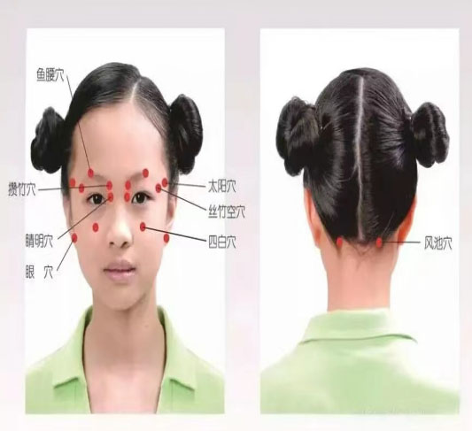 针灸穴位图